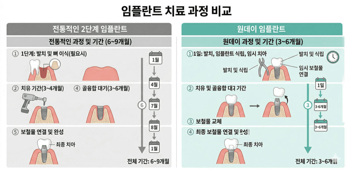 기존 2단계 임플란트 vs 당일 식립 임플란트 비교 인포그래픽